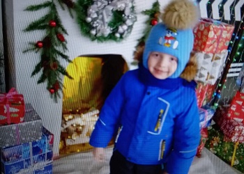 Малышу с ожогами из Приамурья необходима новая пластическая операция в Москве