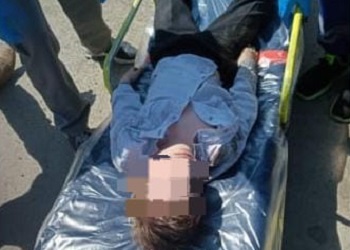 Ребенок, которого в Приамурье сбила иномарка, попал в медучреждение