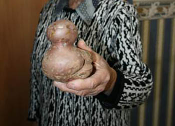 Амурчане вырастили огромный арбуз и картофель в форме утенка